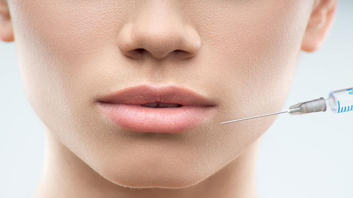 LIPOFILLING
